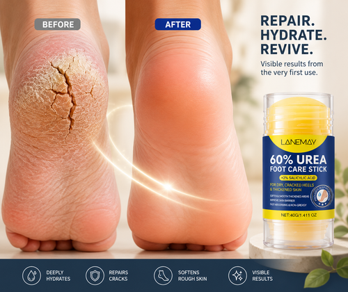 Heelvana™ Foot Repair File